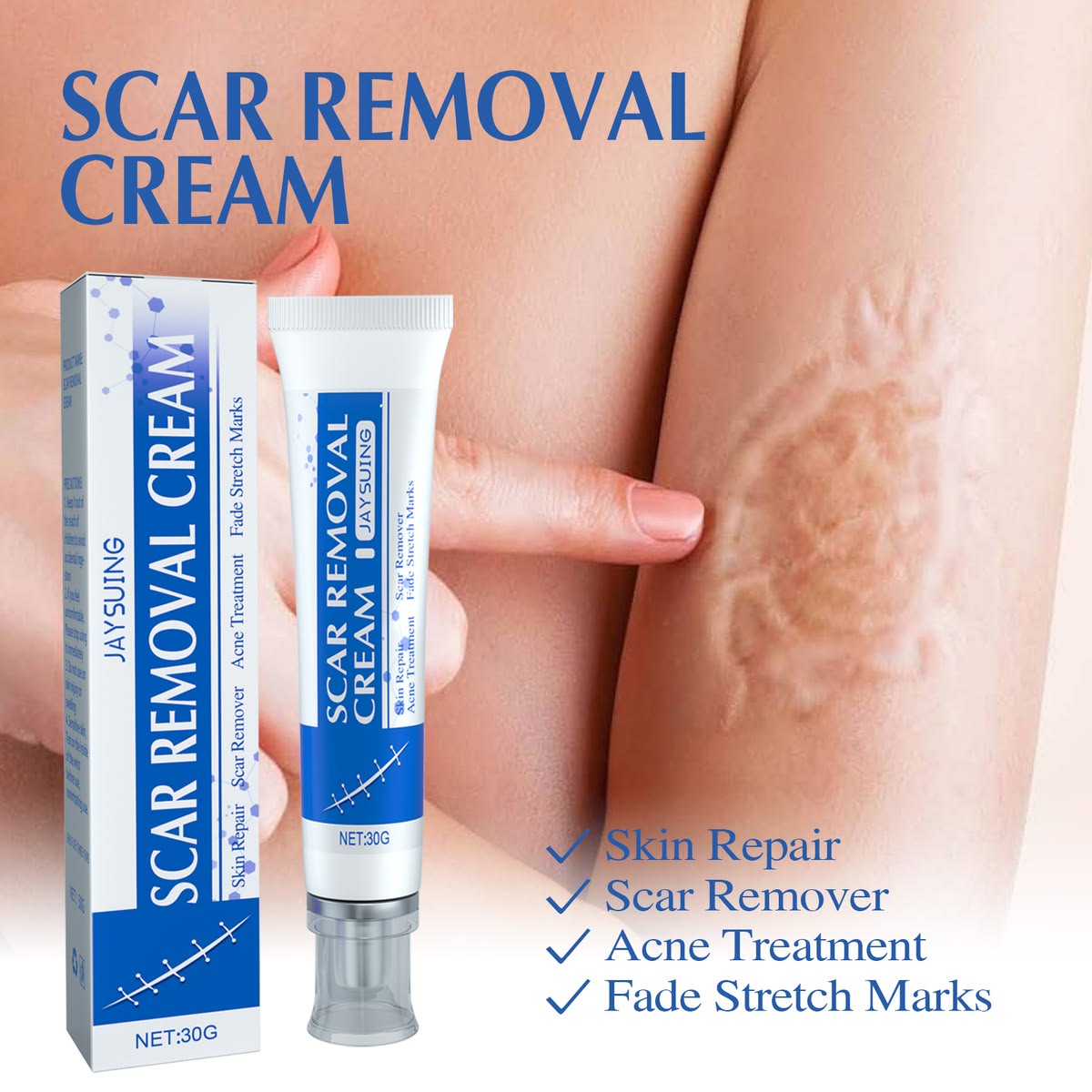 SCAR REMOVAL CREAM