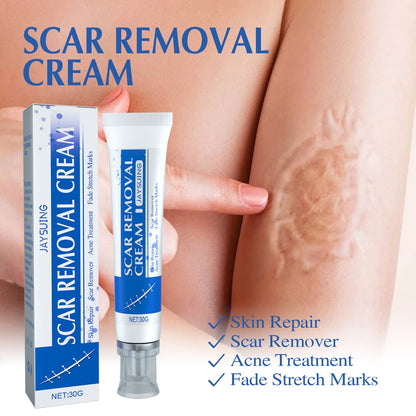 SCAR REMOVAL CREAM